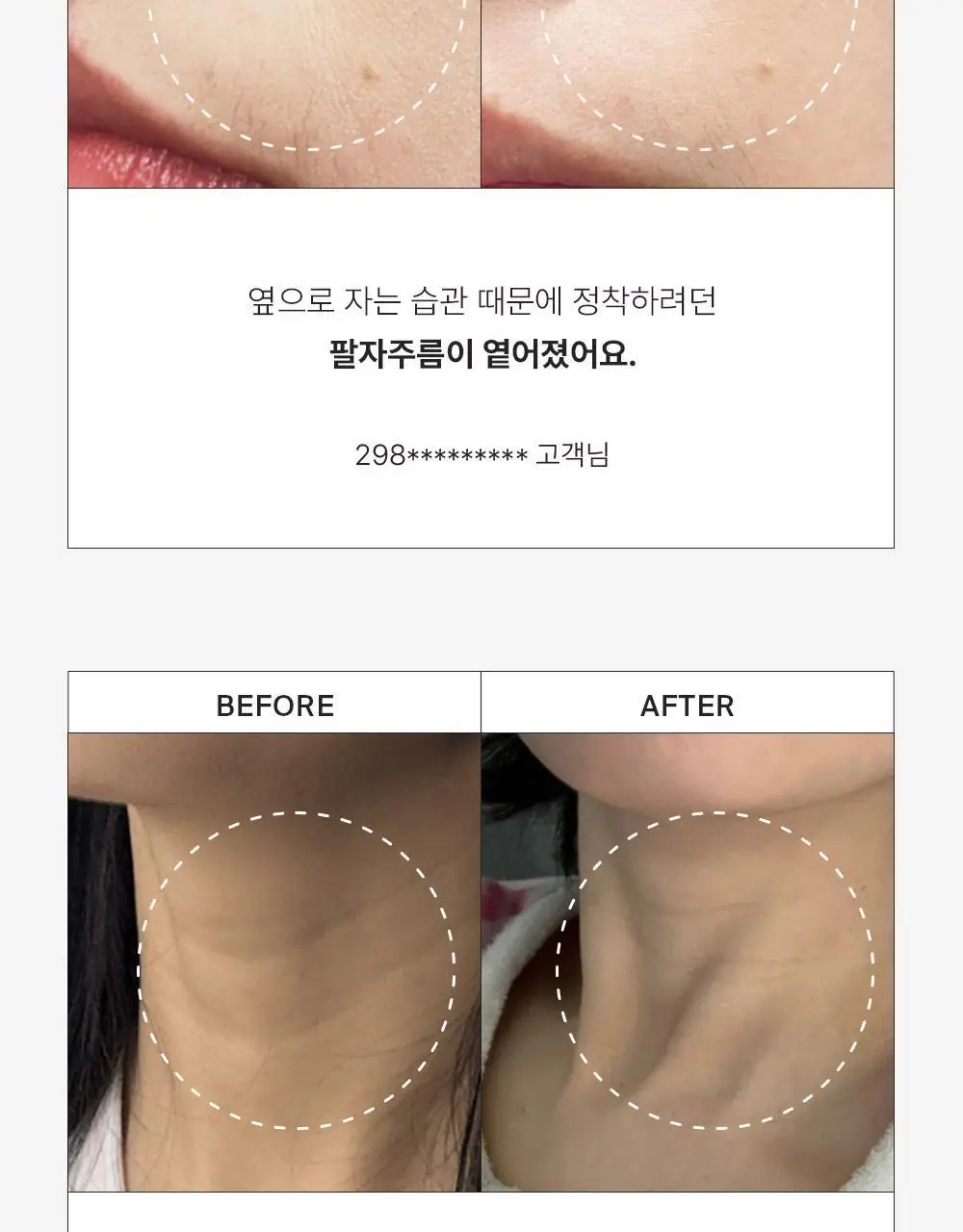 [주름리프팅] 퍼셀 82% 하이-도즈 펩타이드 콜라겐 앰플 20ml 상세페이지 7